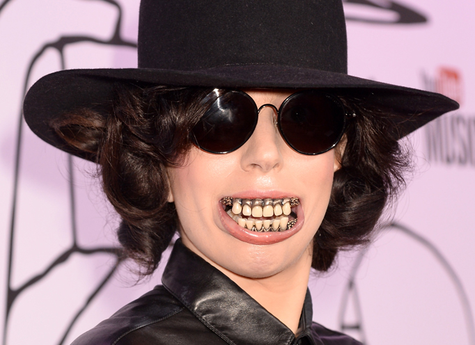 Lady Gaga dentures
