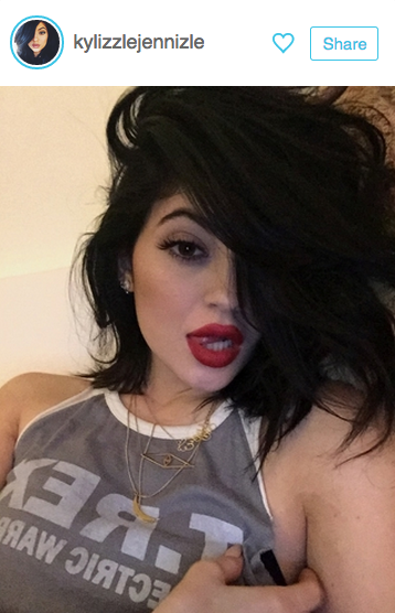 Kylie Jenner Lips shots 2