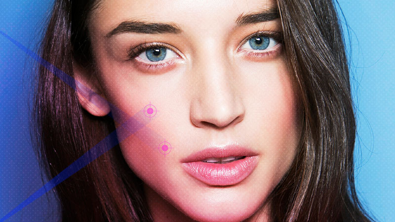 What Laser Acne Treatment Does For Your Skin