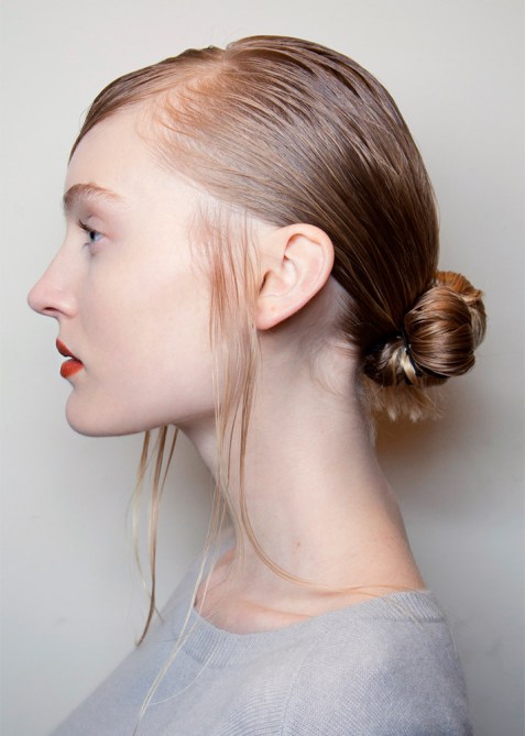 Kybella Chin Fat Injectable Review