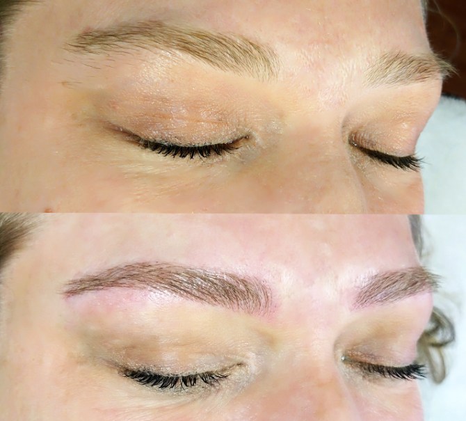 Top: Before; Bottom: After (Photo: Courtesy of Erika Stalder)