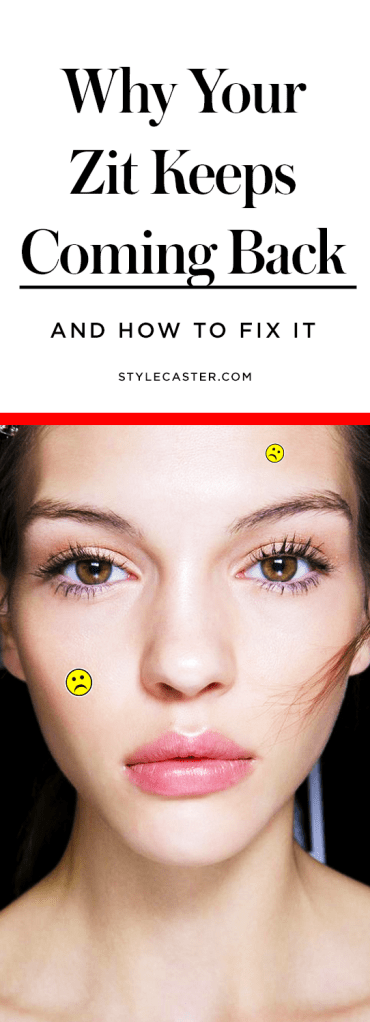 Why zits come back in the same spot, and how to fix it! | Cystic acne + pimple remedies | @stylecaster