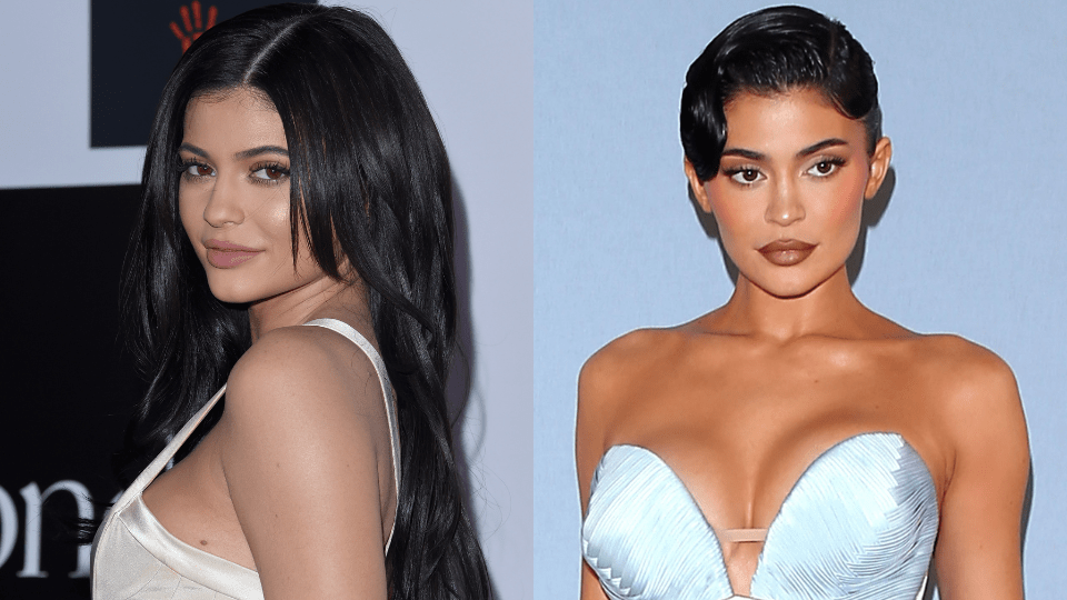 Kylie Jenner in 2015 and now