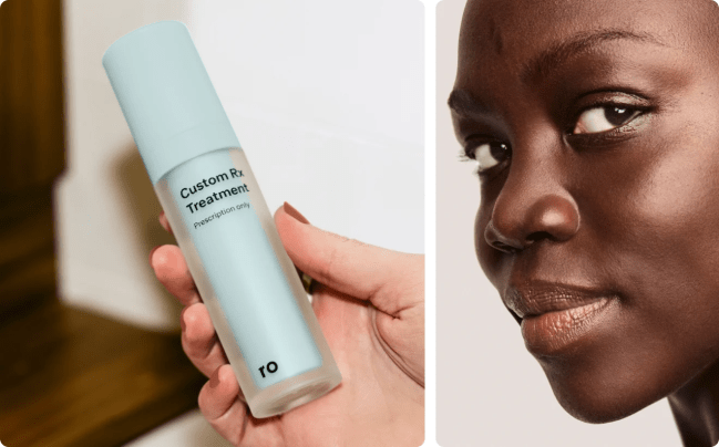 Ro Custom Rx Treatment