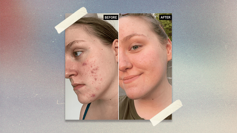 The INKEY List 15% Vitamin C + EGF Serum