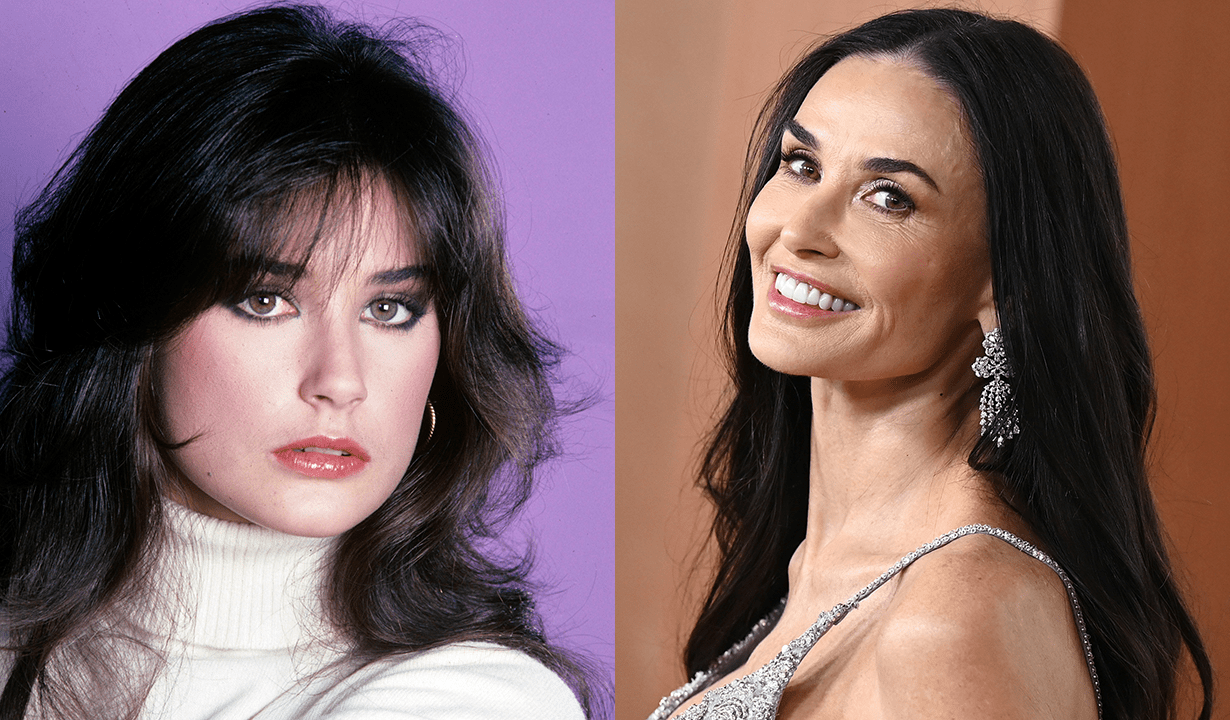Demi Moore Plastic Surgery