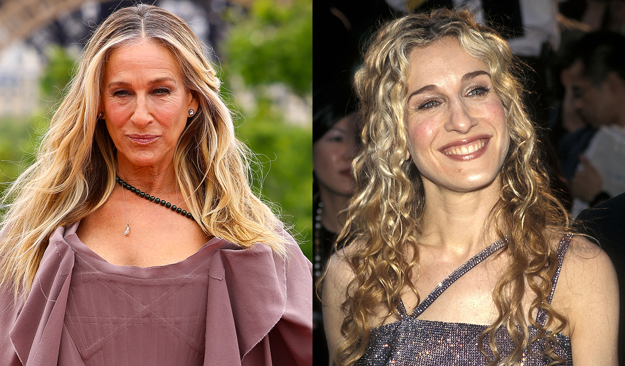 Sarah Jessica Parker Plastic Surgery